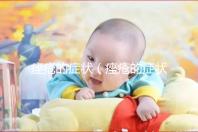 痤瘡的癥狀(痤瘡的癥狀表現有哪些)