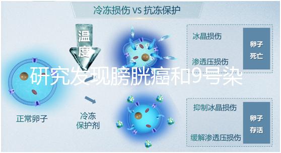 研究發(fā)現(xiàn)膀胱癌和9號(hào)染色體缺失有關(guān)系！