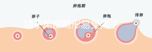 精子尾部畸形易受卵子“嫌棄”，無尾、短卷尾需重視