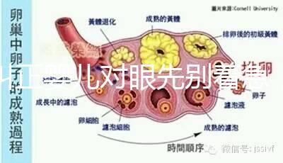 糾正嬰兒對眼先別著急,眼科醫生教你3招鑒別法