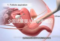 全國(guó)試管嬰兒成功率高的醫(yī)院有哪些？（全國(guó)試管嬰兒成功率高的醫(yī)院目錄一覽）