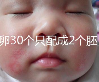 取卵30個只配成2個胚胎別放棄！卵巢傷口小移植成功率不低