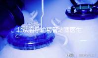 北京治療輸精管堵塞醫(yī)生水平高的醫(yī)院推薦