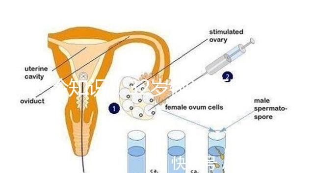 冷知識(shí)！32歲做試管嬰兒提升成功率的方法請(qǐng)收藏