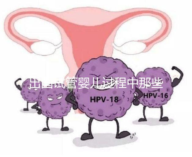 出國(guó)試管嬰兒過(guò)程中那些困惑,12個(gè)常見(jiàn)問(wèn)題釋疑