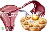 凱格爾運(yùn)動(dòng)怎么做?看看專(zhuān)業(yè)老師分享的分步驟圖解