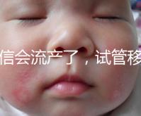 別信會流產了，試管移植后能不能吃胡椒粉聽我說！