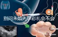 別問未婚先孕彩禮會不會少了，一分不給也不無可能