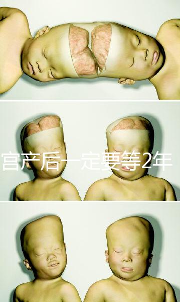 剖宮產后一定要等2年，才能試管嬰兒懷孕嗎？