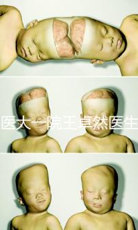 哈醫(yī)大一院王卓然醫(yī)生試管攻略,坐診時間、成功率早知道