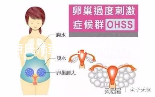 唐氏篩查最好時間是什么時候，內蒙古單項費用不超三百