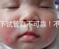 地下試管真不可靠！不知道深圳哪里可以做第三代試管看這里