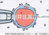 二維彩超并非黑白呈像，通過檢查還能看清胎兒五官