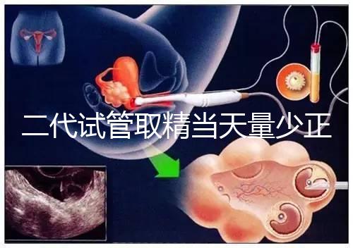 二代試管取精當天量少正不正常60s弄清，不造怎么辦速覽