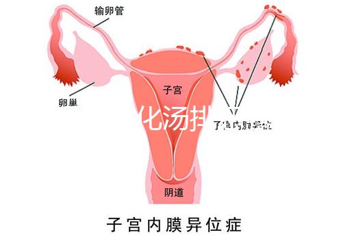 產(chǎn)后喝生化湯排惡露會(huì)使寶寶拉肚子?醫(yī)生:時(shí)間沒用對(duì)