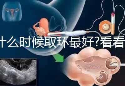 什么時(shí)候取環(huán)最好?看看各地姐妹們有什么經(jīng)驗(yàn)之談