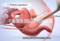 不看醫(yī)生團(tuán)隊!選擇拉霍亞試管嬰兒中心的優(yōu)勢還有這些