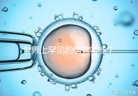 世界上罕見的病有哪些？胱氨酸貯積癥100%上榜