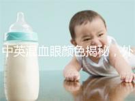 中英混血眼顏色揭秘，外觀特征，長什么樣的快速收藏