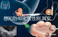 想知肚中寶寶性別,其實(shí)唐篩單子上有男女暗示