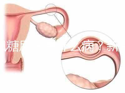 楓糖尿病是什么?。啃律鷥哼@5個指標(biāo)偏低要注意了
