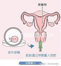 柳州幾個醫(yī)院能做第三代試管嬰兒？詳細的費用成功率都在這