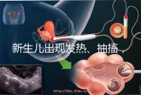 新生兒出現(xiàn)發(fā)熱、抽搐，很可能是胎毒的表現(xiàn)