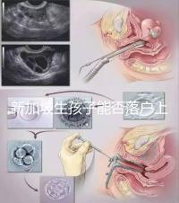 新加坡生孩子能否落戶上海分，@家長:高學歷可以申請