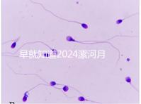 早就知道2024漯河月子中心的價格表了!媽咪悅只需要這個數(shù)字