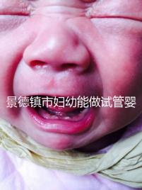 景德鎮市婦幼能做試管嬰兒嗎？江西這些地區是熱門選擇