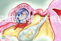 武漢做試管嬰兒大概要多少錢？