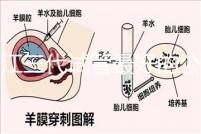 浙江三代試管最好的公立醫院推薦，參考性大隨你挑