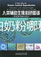 水解蛋白奶粉哪種好？口感和消化分析這個品牌出彩