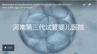 河南第三代試管嬰兒醫院整理，成功率、費用全在這