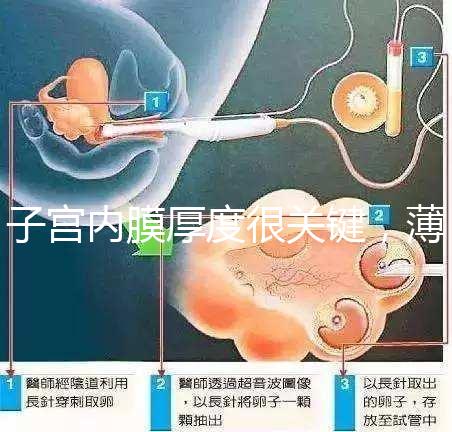 子宮內膜厚度很關鍵，薄了厚了試管嬰兒都難成功