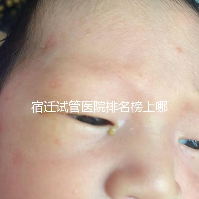 宿遷試管醫院排名榜上哪家好，不造助孕成功率和費用別亂選