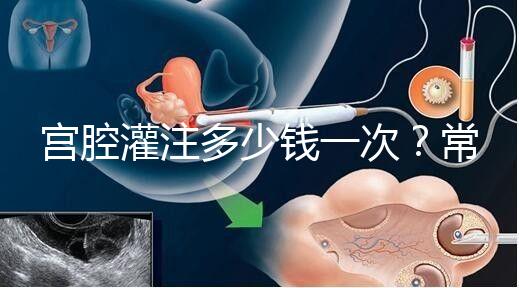 宮腔灌注多少錢一次？常見疑問匯總答疑