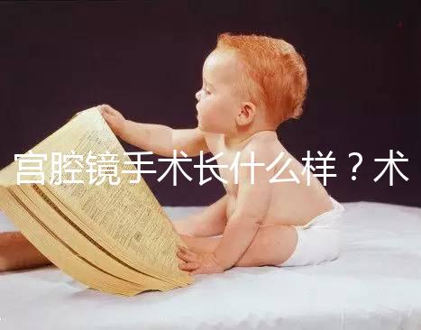 宮腔鏡手術(shù)長(zhǎng)什么樣？術(shù)后要注意什么？ ?