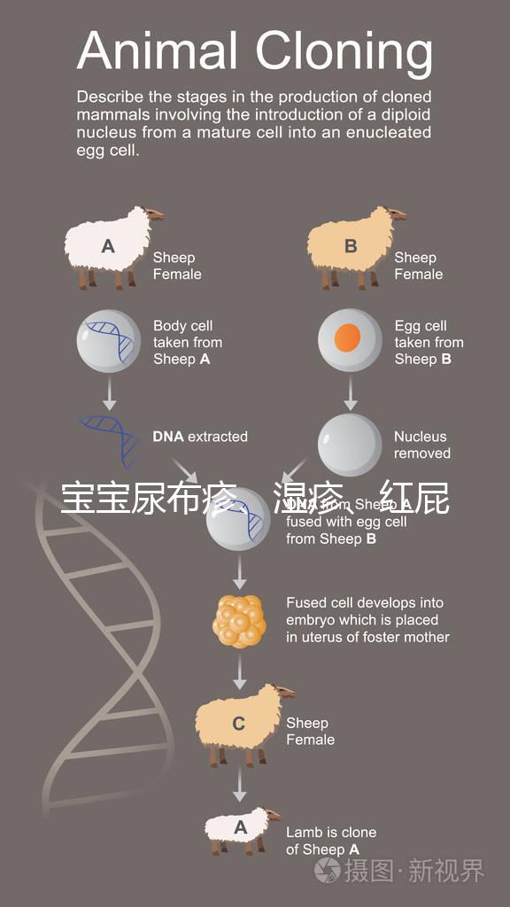 寶寶尿布疹、濕疹、紅屁股傻傻分不清？4點(diǎn)區(qū)別輕松診斷