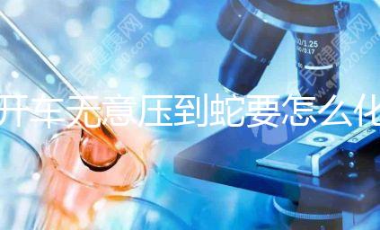 開車無意壓到蛇要怎么化解進來瞧，要不要報警一目了然