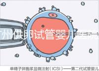 廣州供卵試管嬰兒醫院匯總，真實案例告訴你廣東哪家最好
