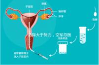 選擇大于努力，空軍總醫院做試管嬰兒必讀攻略