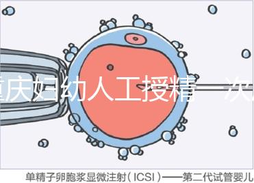 重慶婦幼人工授精一次成功率揭秘,移植費用貴有原因