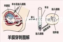 脊柱側彎s型懷孕莫慌張，能否順產還得看這4大要素