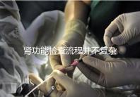 腎功能檢查流程并不復(fù)雜，掌握這幾個步驟方可一步到位