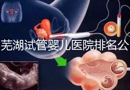 蕪湖試管嬰兒醫(yī)院排名公開，弋磯山醫(yī)院、蕪湖二院獲好評