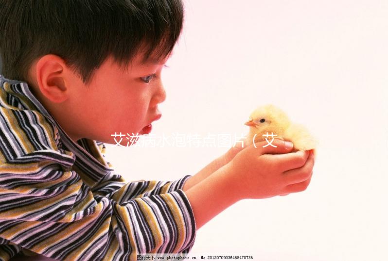 艾滋病水泡特點圖片(艾滋病水泡特點圖片高清)