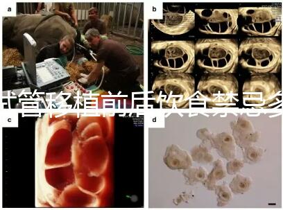 試管移植前后飲食禁忌多，十大不利于胚胎著床的水果別亂吃