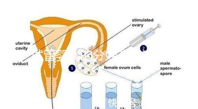 試管嬰兒的分娩方式有哪些？能否自然分娩取決于情況