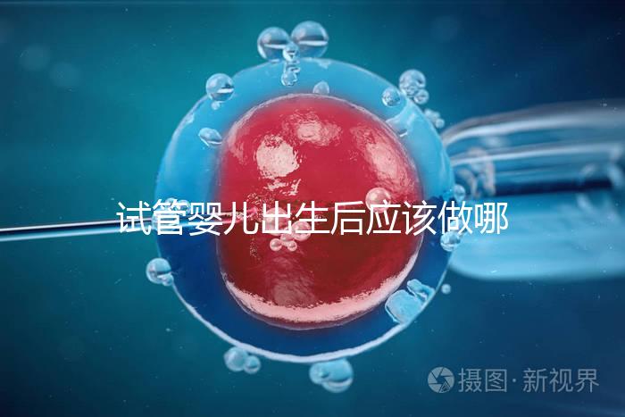 試管嬰兒出生后應該做哪些檢查答案？DR應該看情況嗎？